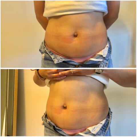 Mimiann 美容美學 - 媽媽的願望-平坦的小腹1