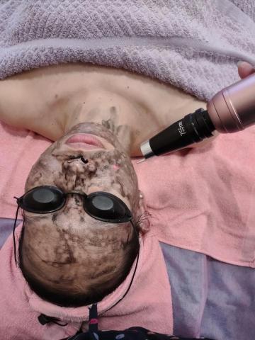 Ailsa美妍中心 - 755美白几，斑，痘痘，老廢角質，膚色不均都能改善