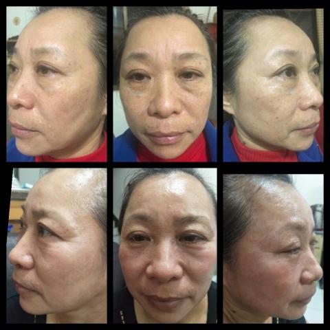 范姜語褀 - 使用前上面使用後下面