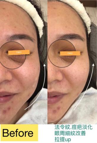 魔法素［V mofa］ - 