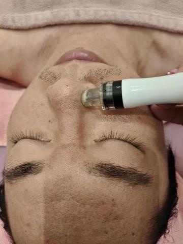 Ailsa美妍中心 - 韓國皮膚管理，水飛梭無痛洗粉刺