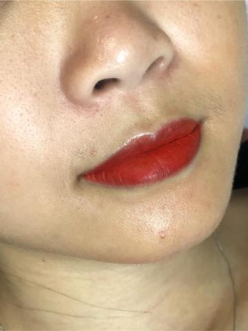 Destino 美學 - 美唇