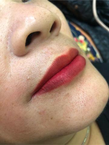 Destino 美學 - 美唇