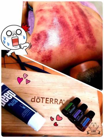 壽司 - 刮痧30分鐘