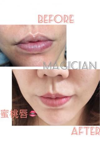 Magician紋藝美學 - 脫痂完2個月的蜜桃唇