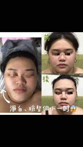 艾蕊形象管理中心 - 顱內課程前後