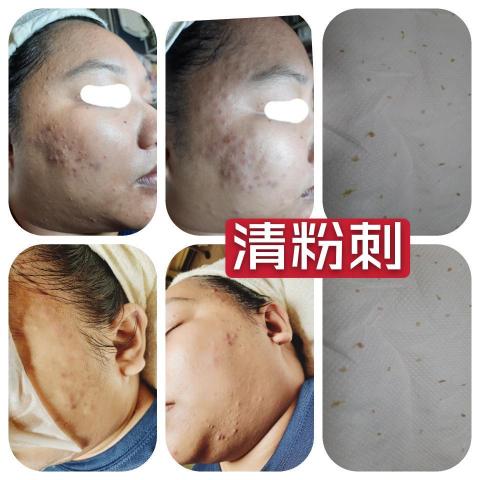 詩育特睫妍 - 清粉刺