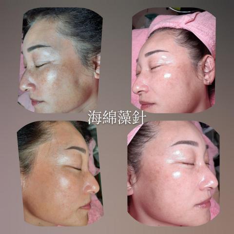 詩育特睫妍 - 藻針美容