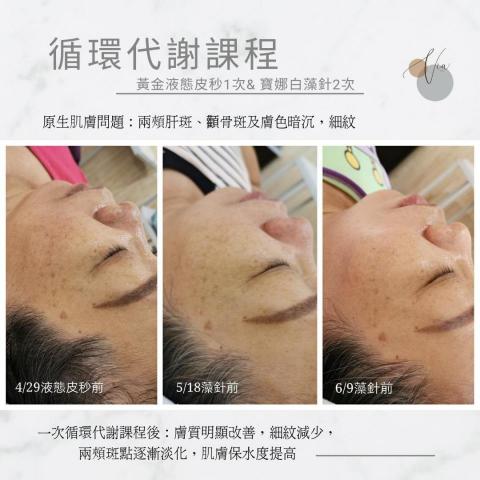 薇亞形象美學 - 循環代謝課程