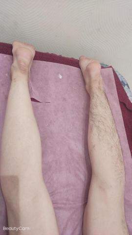 Ailsa美妍中心 - 激光除毛，前後對比