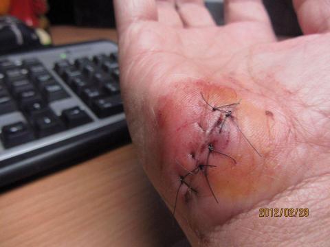 桃園彼得潘狼.愛犬訓練學校 - 即使很小心.也採正向教狗.不過狗教多了.難免意外被咬.