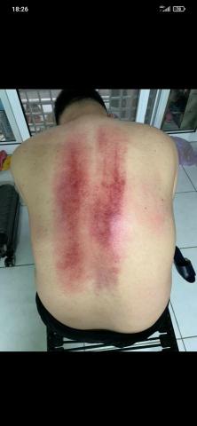 陳師父鬆筋推拿 - 