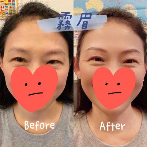 紓壓按摩 - 霧眉