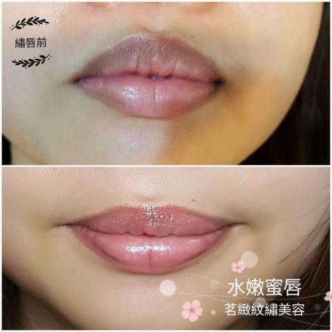茗緻紋繡美容芳療館 - 黑唇還原術