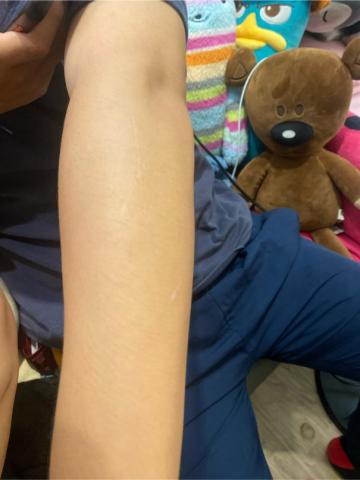 可驊 - 除毛前毛超多?