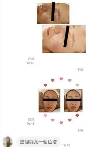 釉spa - 釉SPA-
液態皮秒三重酸亮白保養後客人好評