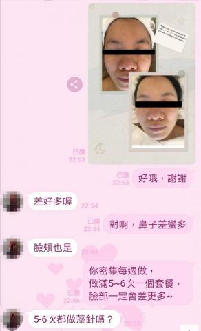 釉spa - 釉SPA-
矽藻藻（針）細胞保養後客人好評