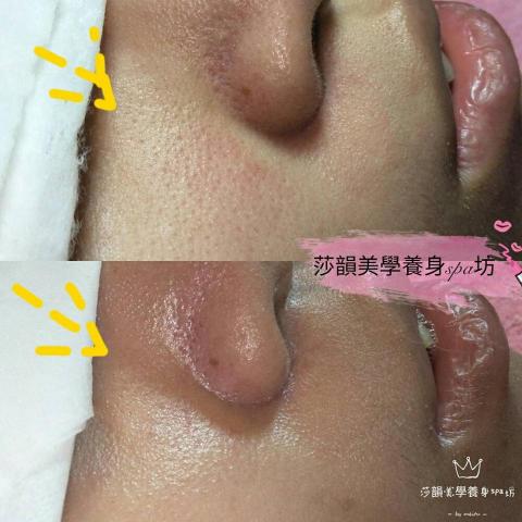 莎韻美學養身spa工作坊 - 微藻針護理~
藻不到任何毛孔粗大及肌膚暗沉~