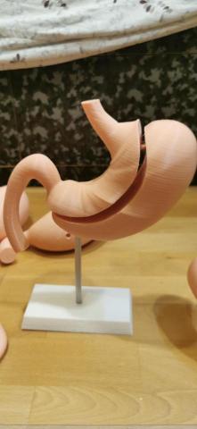 MIOS - 胃建模與列印