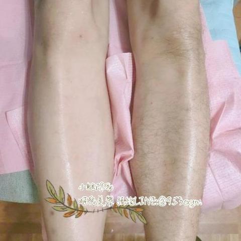 520美學 - 熱蠟除毛讓您褪去毛毛襪，直接秀美肌！