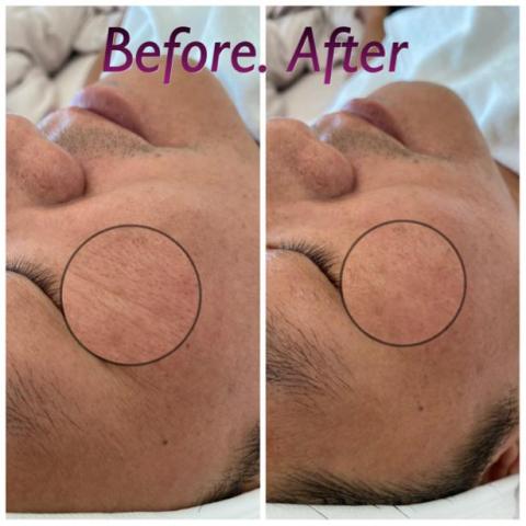 aura healing凈境美身心靈美學 - 改善細紋