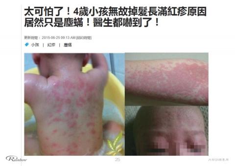 滅蟎王專業到府清潔除塵蟎 -  8