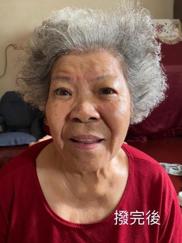 Marina Hsu - 臉部撥經後