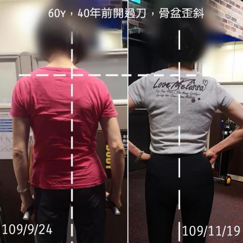 黎震遐 - 骨盆歪斜矯正訓練