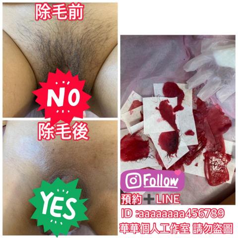 華華個人指油壓 - 男性巴西式除毛