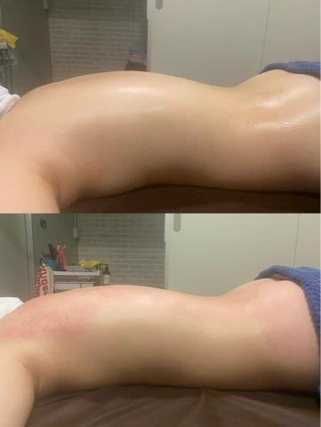 筑元足體舒鬆館 - 膜痧撥經調理120分3000元