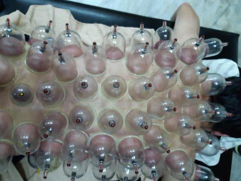 盧師傅 威力養生館 - 全身深層推拿拔罐