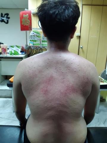 盧師傅 威力養生館 - 全身推拿整復後