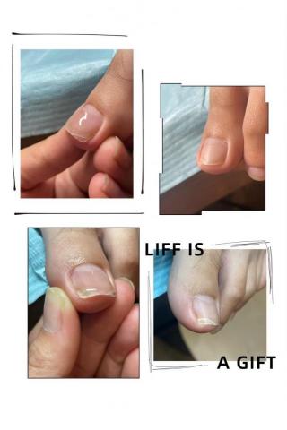 虎尾心祺複合式美業 - 凍甲 崁甲調整 #雲林虎尾凍甲