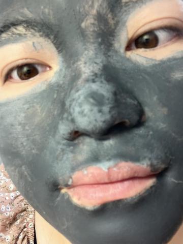 趙心田 - 去角質面膜,添加2%水楊酸,促進角質代謝,高嶺土吸附肌膚髒污以及油脂。
圖上深色為吸附油脂的區塊 趙心田 - 去角質面膜,添加2%水楊酸,促進角質代謝,高嶺土吸附肌膚髒污以及油脂。
圖上深色為吸附油脂的區塊