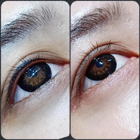 零極限全方位美學 - 