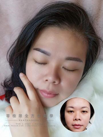 零極限全方位美學 - 