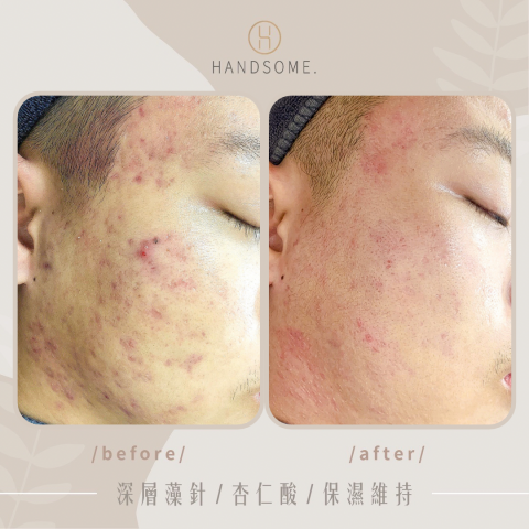 帥哥美容工作室 - 客戶對比