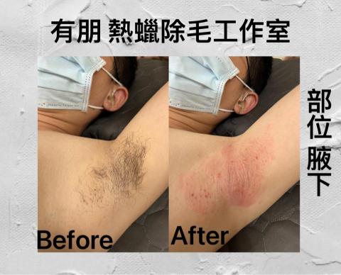有朋熱蠟除毛 - 