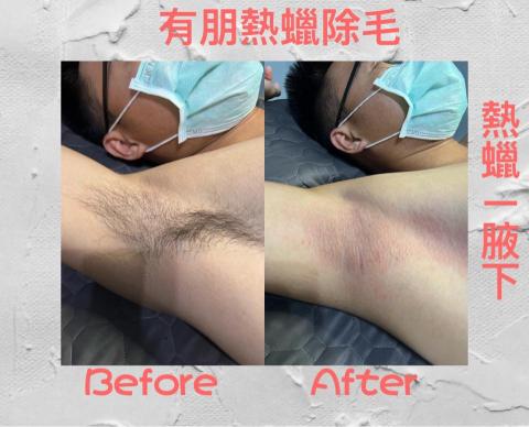 有朋熱蠟除毛 - 