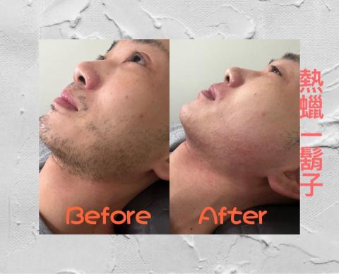 有朋熱蠟除毛 - 