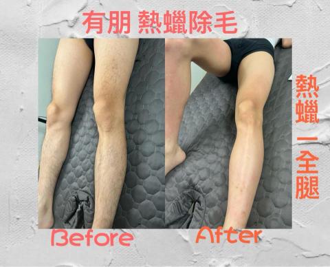 有朋熱蠟除毛 - 