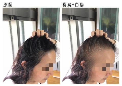 美樂蒂 - 產品需求，將髮量減少、增加白髮