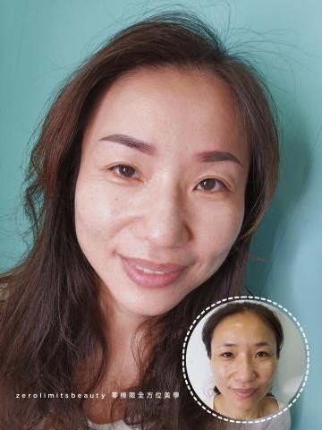 零極限全方位美學 - https://www.facebook.com/zerolimitsbeauty

https://instagram.com/zerolimitsbeauty?igshid=YmMyMTA2M2Y=
