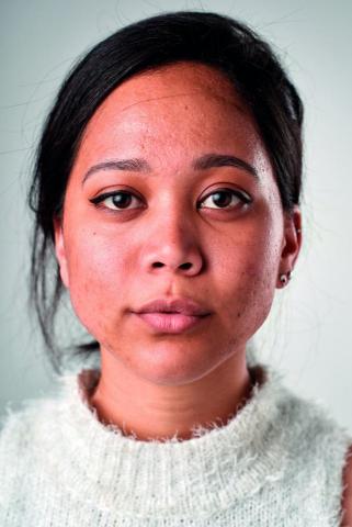 Anne - 人物膚質精修及五官對稱（前）