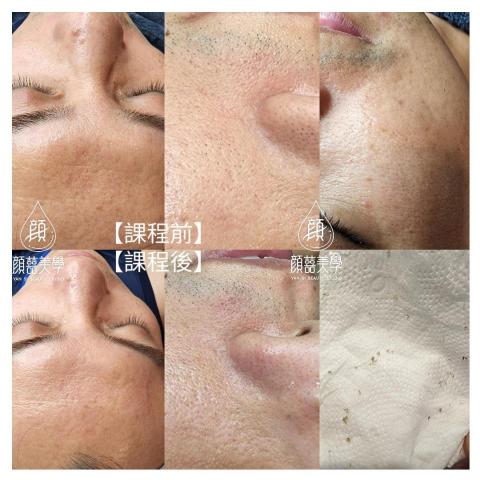 顏囍／囍顏美學 - 肌膚保養