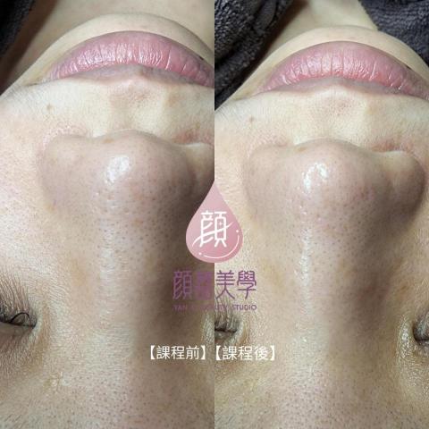 顏囍／囍顏美學 - 肌膚管理保養