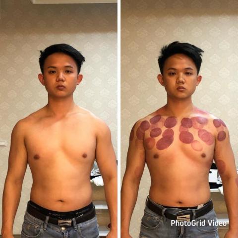 小胖運動按摩 - 高低肩調整