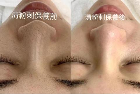 三重做臉寶麗萊美容Spa -  三重做臉寶麗萊美容Spa -