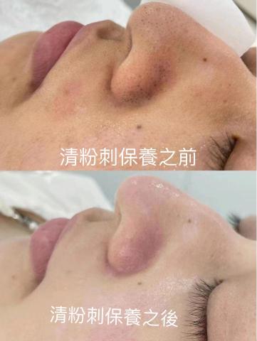 三重做臉寶麗萊美容Spa -  三重做臉寶麗萊美容Spa -
