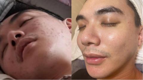 三重做臉寶麗萊美容Spa -  三重做臉寶麗萊美容Spa -